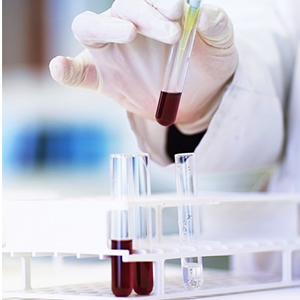 Plastic proefbuizen met rek en dop, 16 x 100 mm met houder voor wetenschappelijke experimenten, Perlen vloeistof 2