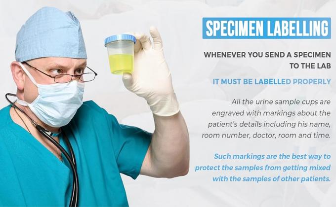 Voorraad Probeeltjesbekers met deksels-lekkestoorend deksel- hoge kwaliteit latexvrije polypropyleen plastic- niet-steriele- 25 4 oz 4