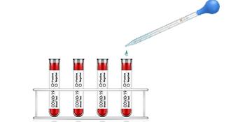 Glas Druppelglas voor geneesmiddelen Pipetten Labdruppel met blauwe rubberen dop en weegschaal (3 ml (2 verpakkingen)) 2