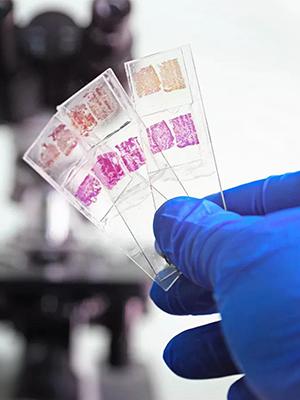 Microscoopplaten en -bedekkingen, lege glazen platen voor de microscoop - 300 platen, 300 bedekkingsplaten voor de microscoop 1