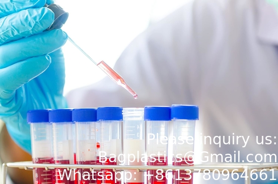 Konieke centrifugebuizen 15 ml, steriele testbuizen van kunststof met schroefkappen, polypropyleencontainer met graduate